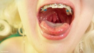 Braces Mouth Tour Video - CloseUp Vore Fetish - Tongue Saliva
